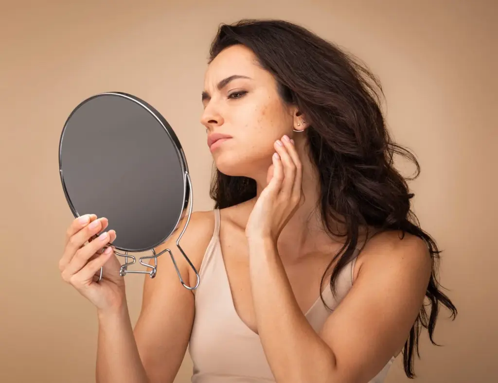 Acne Treatments in Maple Grove | BBL, Moxi & Microneedling in Maple Grove